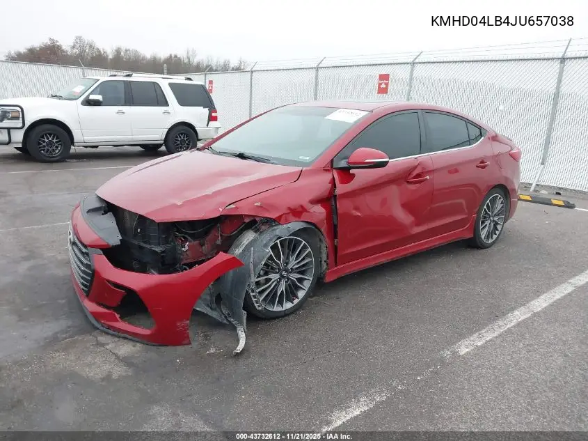 KMHD04LB4JU657038 2018 Hyundai Elantra Sport