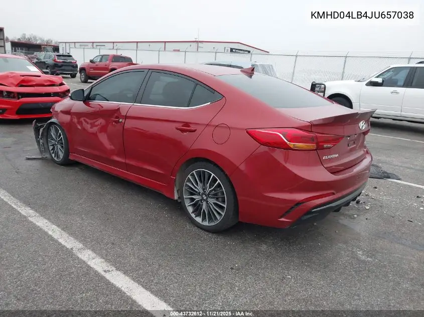 KMHD04LB4JU657038 2018 Hyundai Elantra Sport