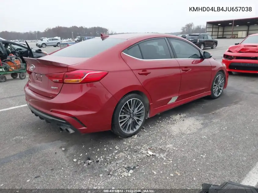 KMHD04LB4JU657038 2018 Hyundai Elantra Sport