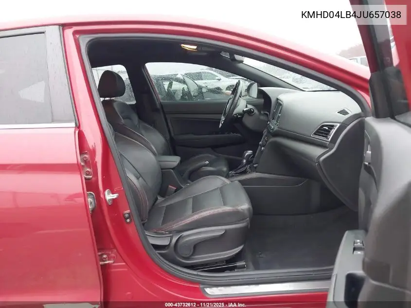 KMHD04LB4JU657038 2018 Hyundai Elantra Sport