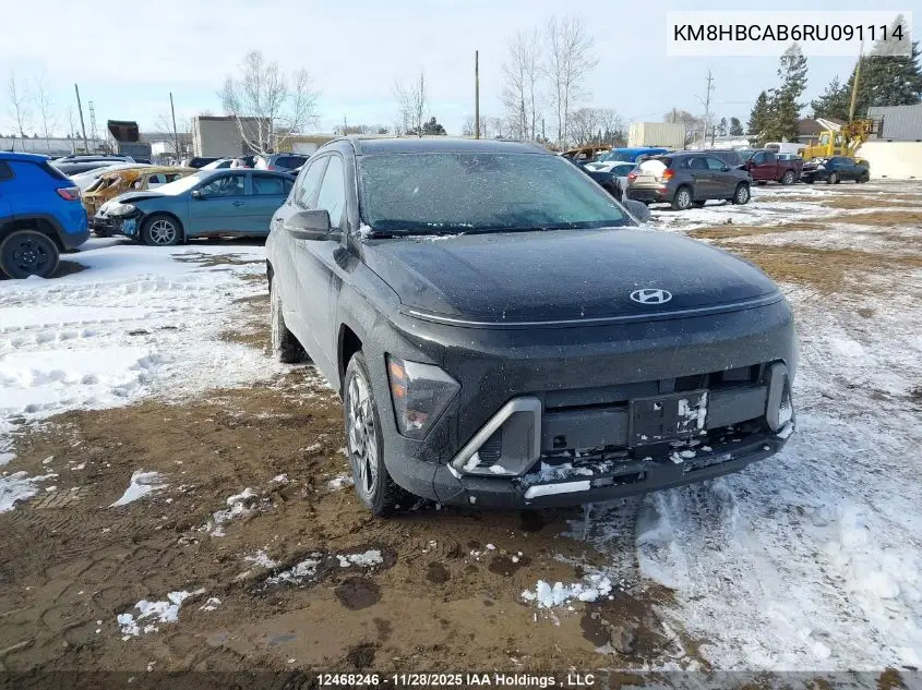 KM8HBCAB6RU091114 2024 Hyundai Kona Sel