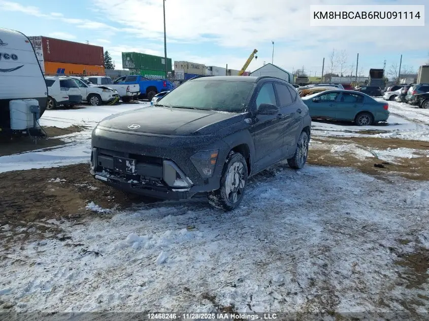 KM8HBCAB6RU091114 2024 Hyundai Kona Sel